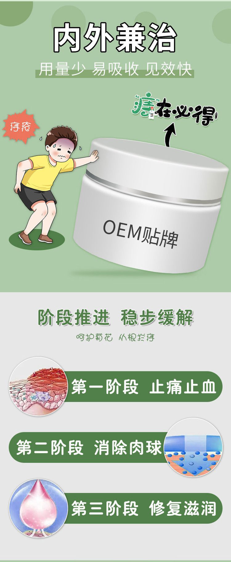 膏藥代加工廠家-痔瘡膏內外兼治
